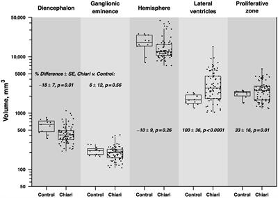 Abnormal prenatal brain development in Chiari II malformation